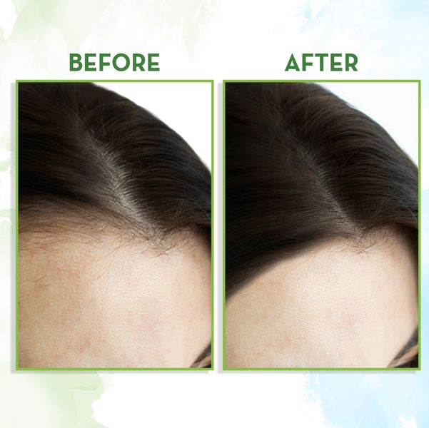Rosemary Hair Growth Oil - Stimulate Hair Growth Rosemary Hair Growth Oil - Stimulate Hair Growth