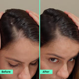 Anti-Hair Fall Advanced Serum & Shampoo Anti-Hair Fall Advanced Serum & Shampoo