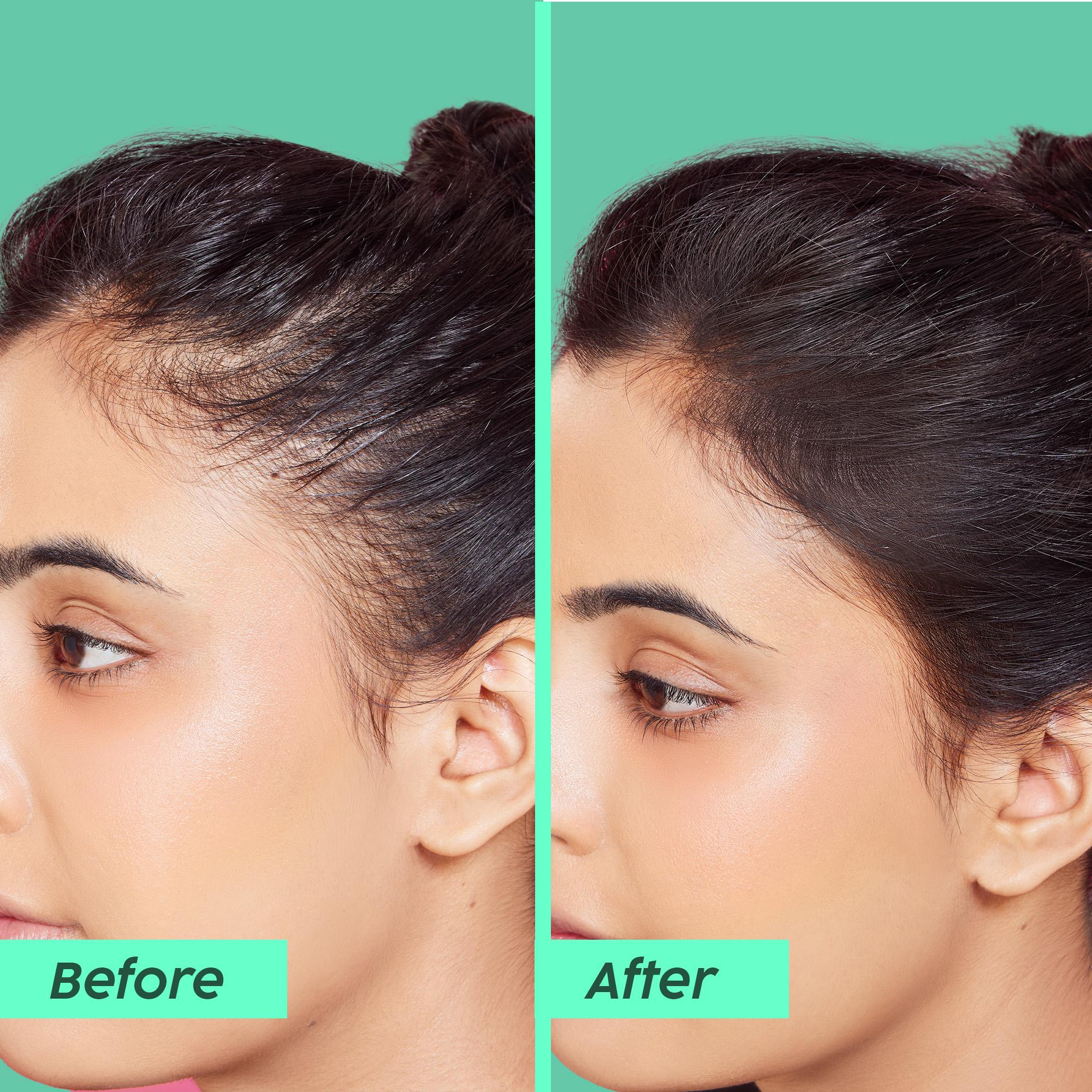 Anti-Hairfall Shampoo for Cleansing & Stronger Hair Anti-Hairfall Shampoo for Cleansing & Stronger Hair