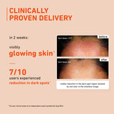 Vitamin C Face Serum with Glow Boost