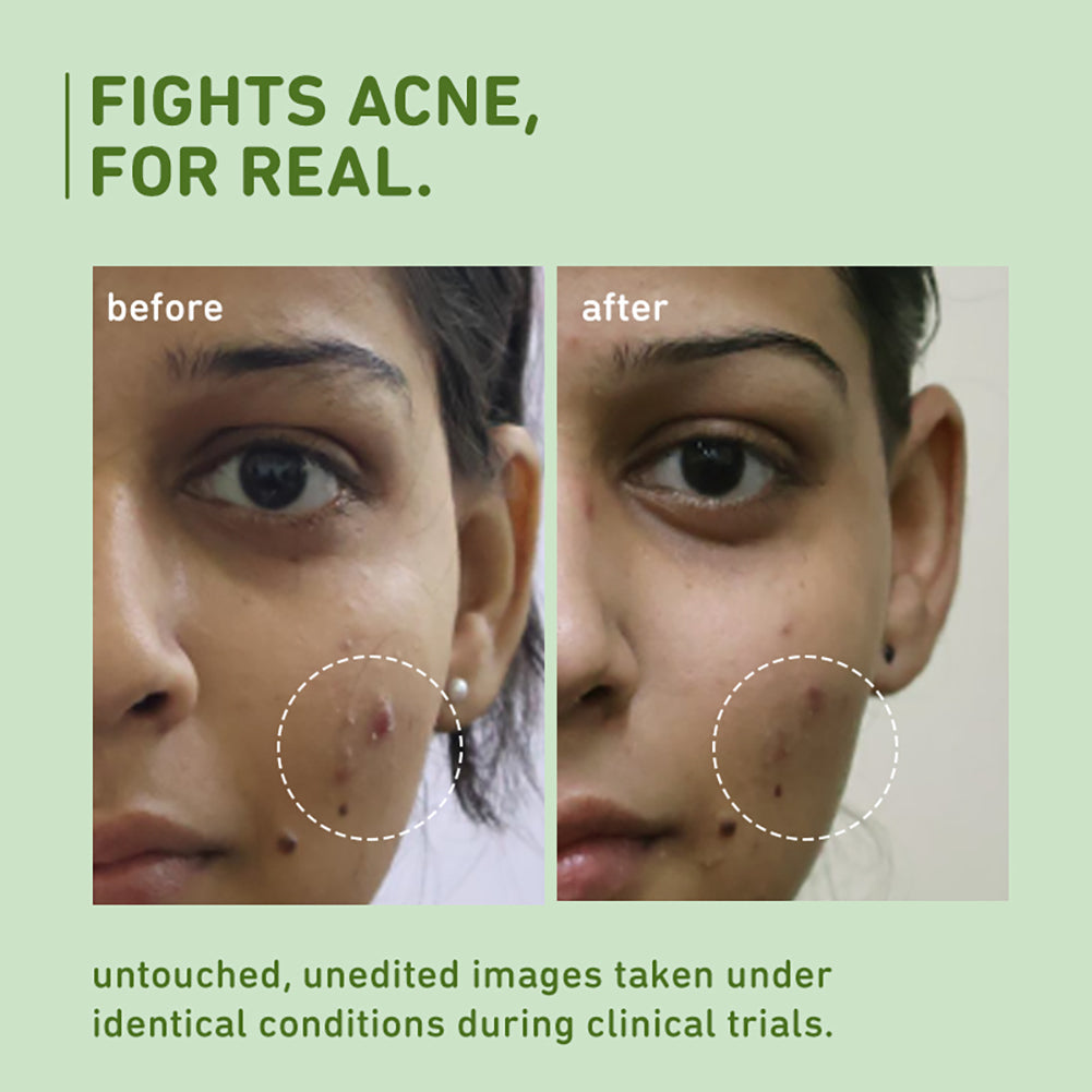 Pore Cleansing Face Wash with Green Tea