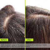 Advanced Anti-Dandruff Conditioner with Neem