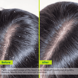 Advanced Anti-Dandruff Conditioner with Neem