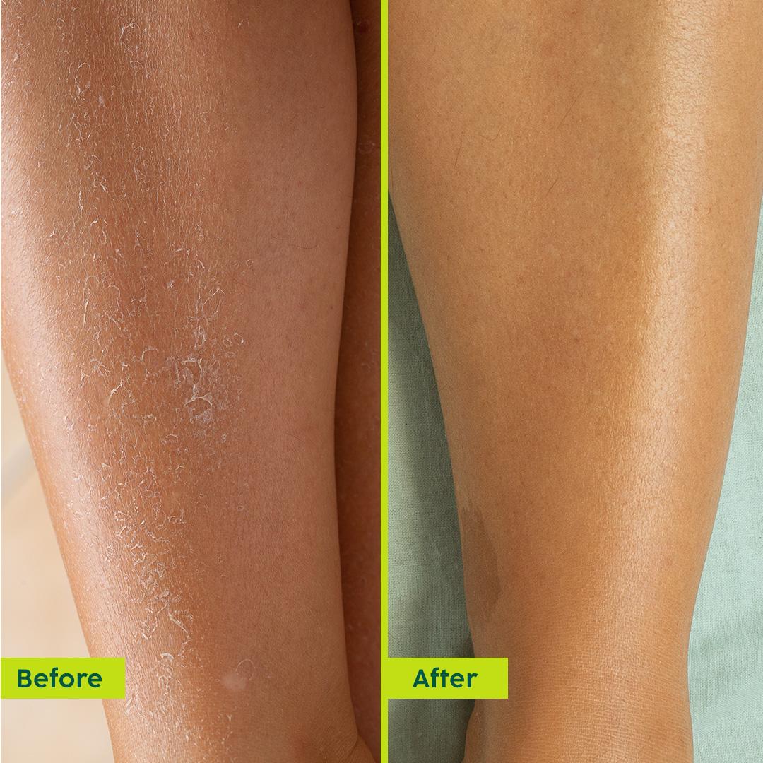 Moisture Rush Luxury Body Butter for Smooth Skin