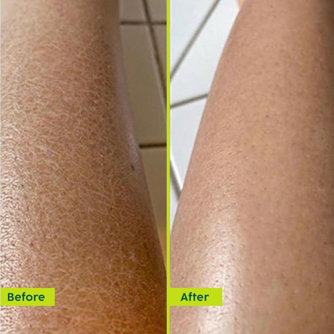 Moisture Rush Luxury Body Butter for Smooth Skin