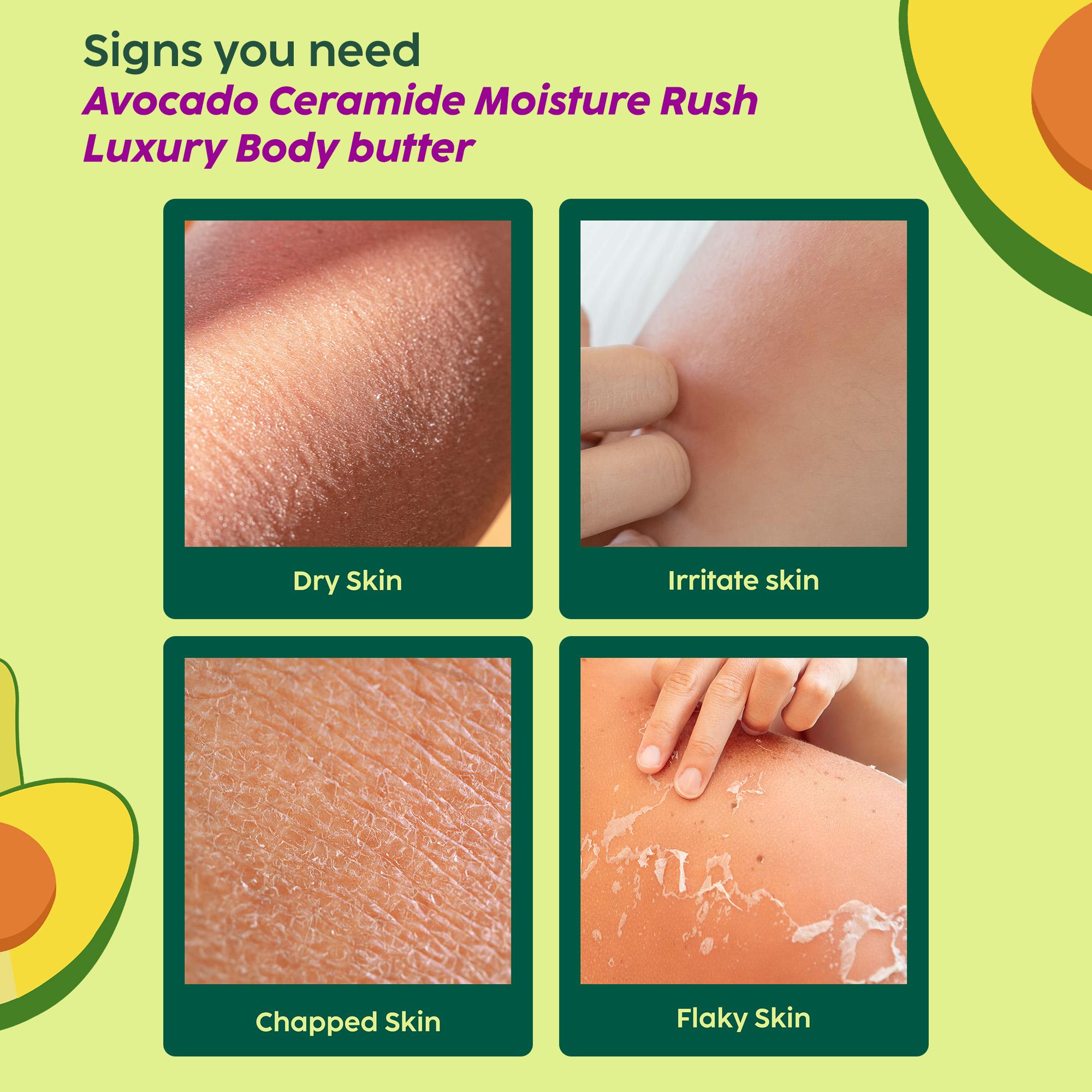 Moisture Rush Luxury Body Butter for Smooth Skin