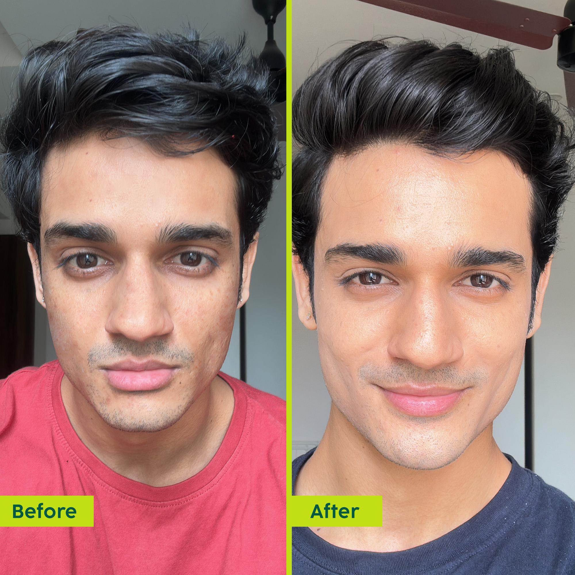 Avocado Ceramide Moisture Serum & Cream
