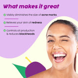 Niacinamide Face Serum for Blemish & Acne Mark Removal