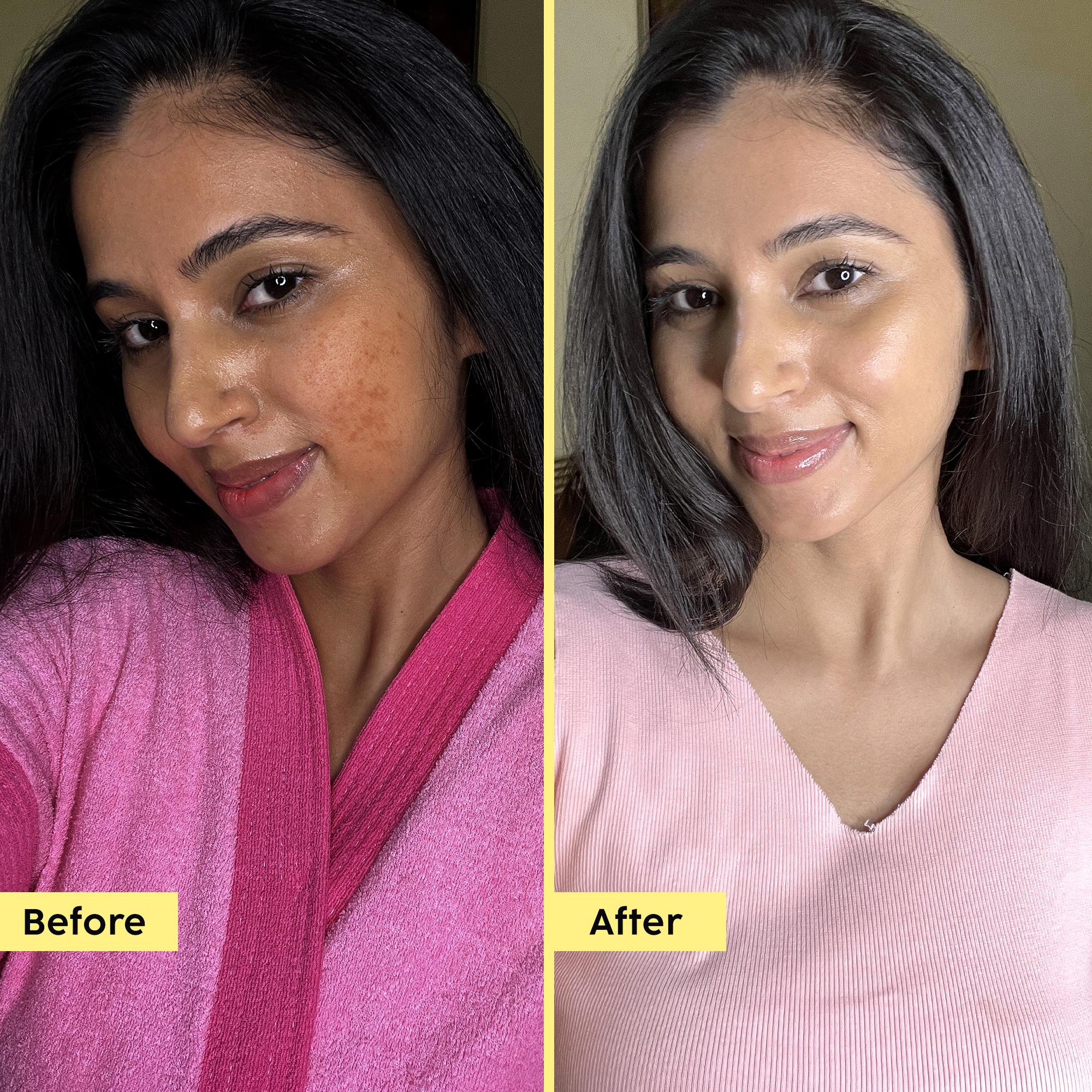 Pineapple De-pigmentation Facewash with Niacinamide