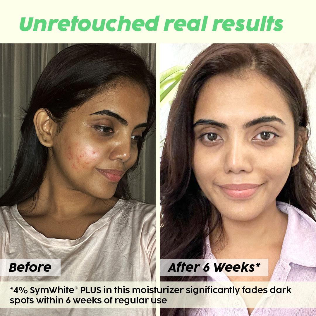 Depigmentation Face Cream for Dark Spots & Hydration