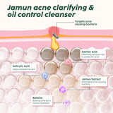 Salicylic Acid Cleanser for Acne Prone Skin