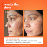 Vitamin C Glow Serum with Barrier Boosting