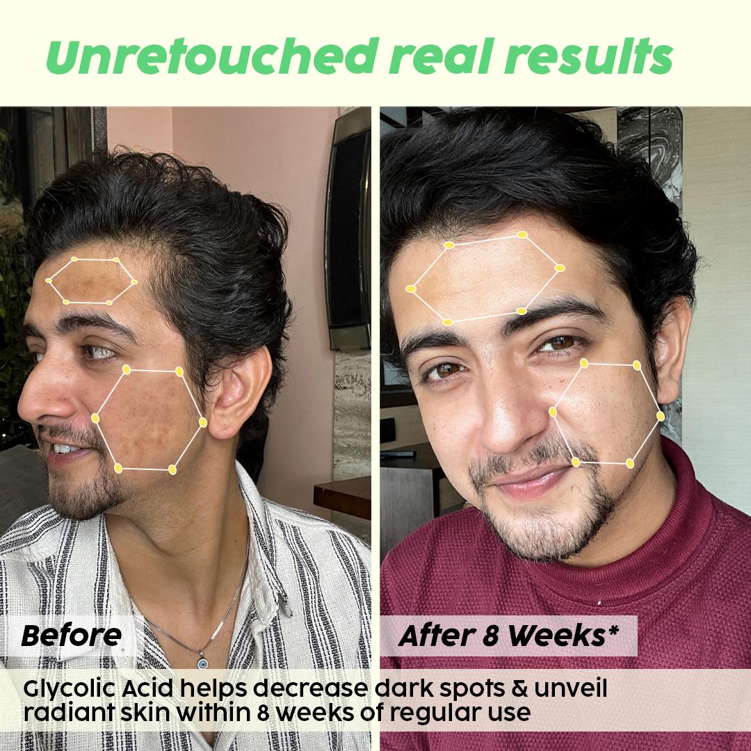 Glycolic Acid Serum for Radiant Skin