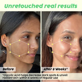Glycolic Acid Serum for Radiant Skin