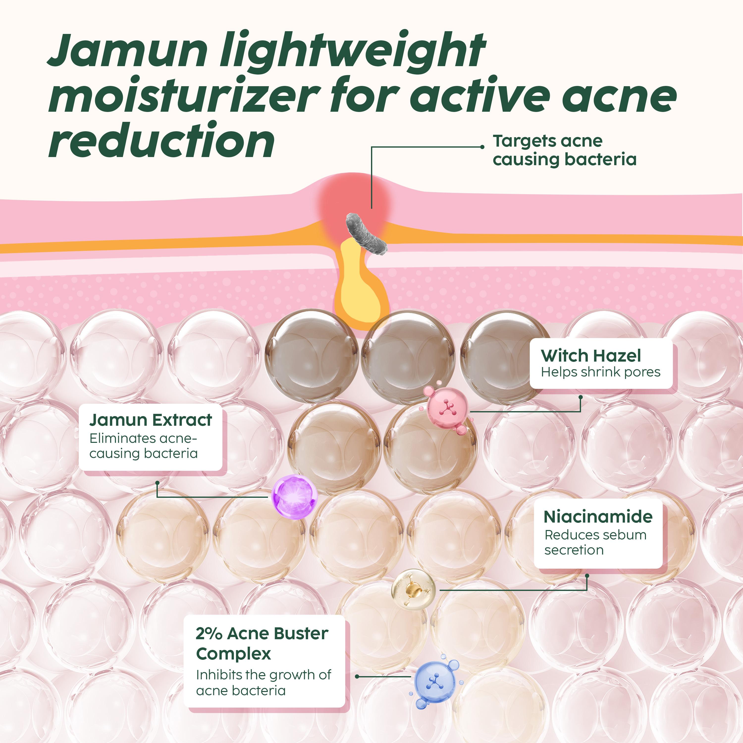 Niacinamide Moisturizer for Acne Control