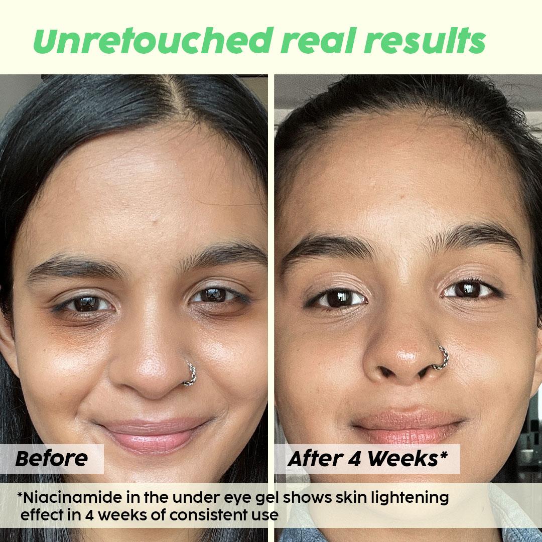 Under Eye Gel for Dark Circles and Puffiness