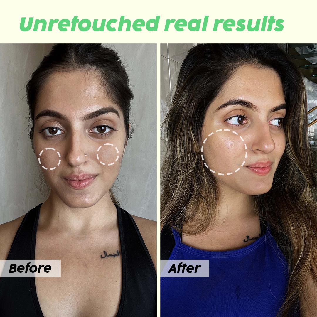 De-pigmentation Facewash with Niacinamide