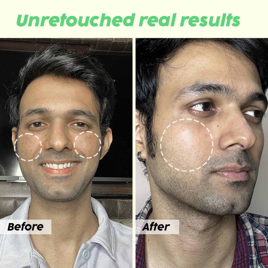 De-pigmentation Facewash with Niacinamide