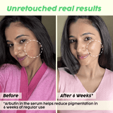De-pigmentation Facewash with Niacinamide