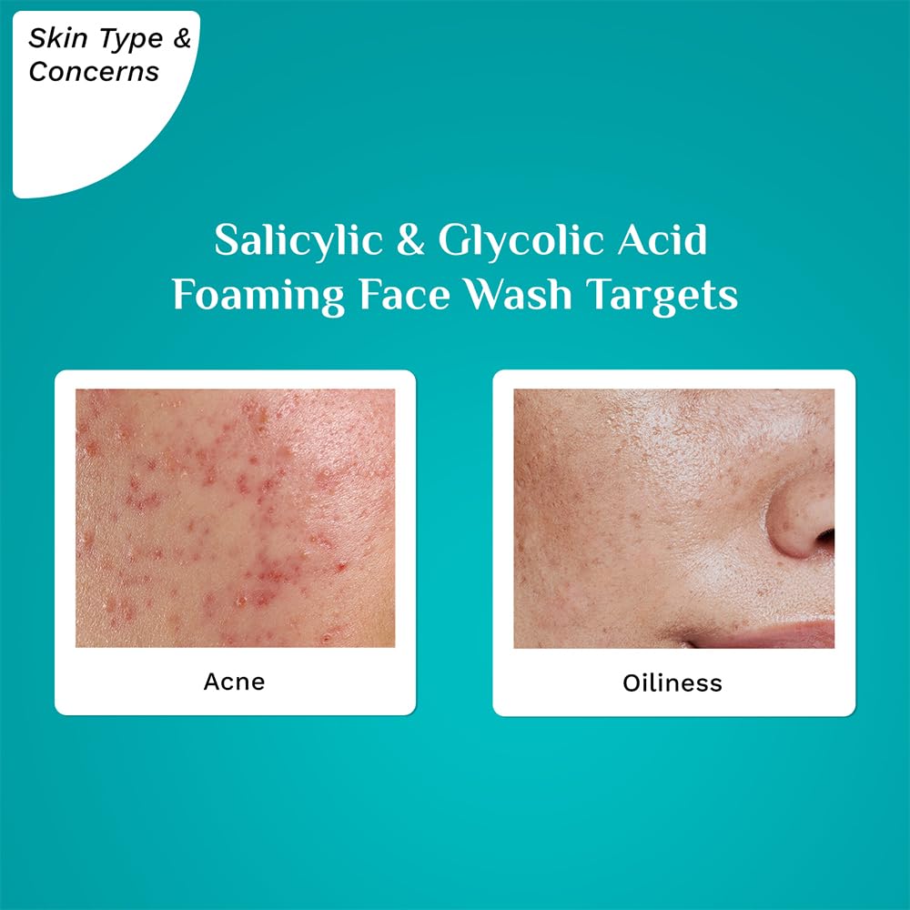 सैलिसिलिक और ग्लाइकोलिक एसिड फोमिंग फेस वॉश