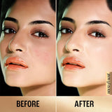 Lakme 9 to 5 Super Matte Foundation Niacinamide Foundation