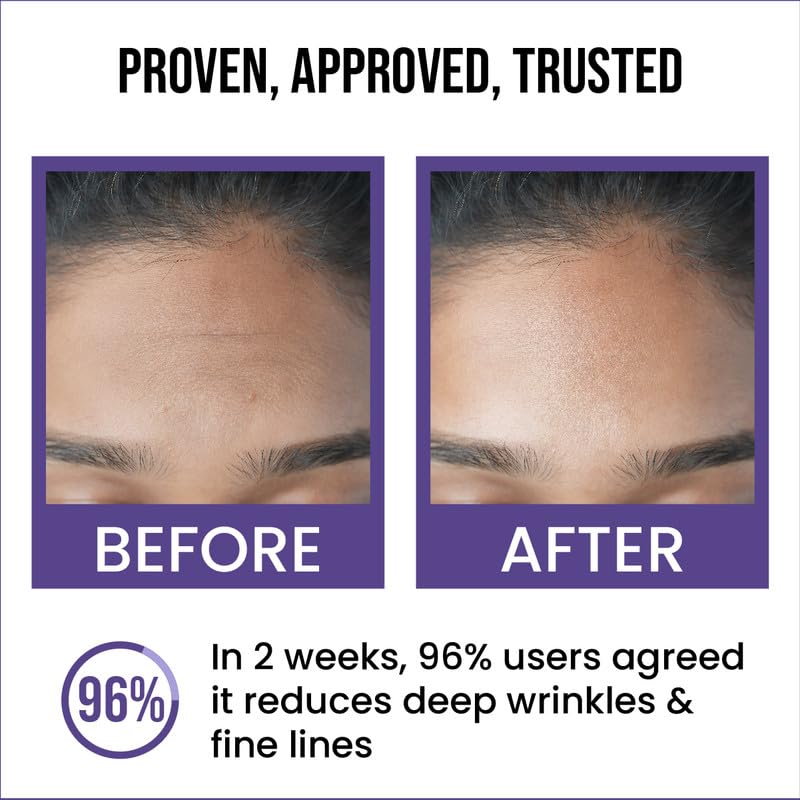 Insight Cosmetics 0.5% Retinol Anti-Ageing Face Serum, 30ml