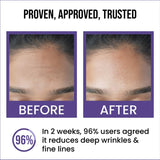 Insight Cosmetics 0.5% Retinol Anti-Ageing Face Serum, 30ml