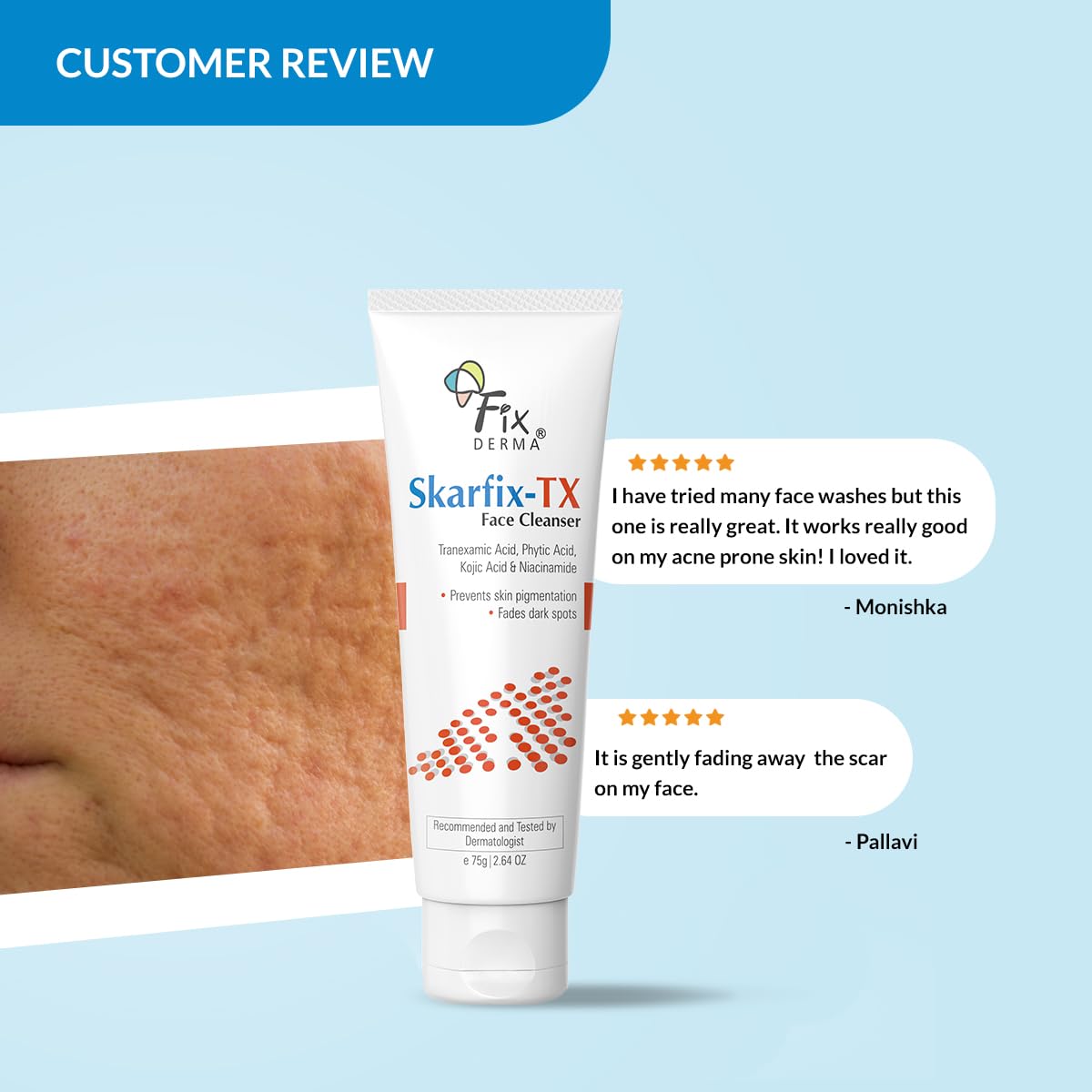 Fixderma Skarfix -TX Face Cleanser with Tranexamic Acid, Kojic Acid & Niacinamide | Kojic Acid Face Wash | Pigmentation Face Wash for All Skin Types - 75gm