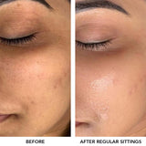 O3+ Meladerm Vitamin C Gel Bleach Free O3+ Facialist Hyaluronic Hydroxy Cellulose Mask