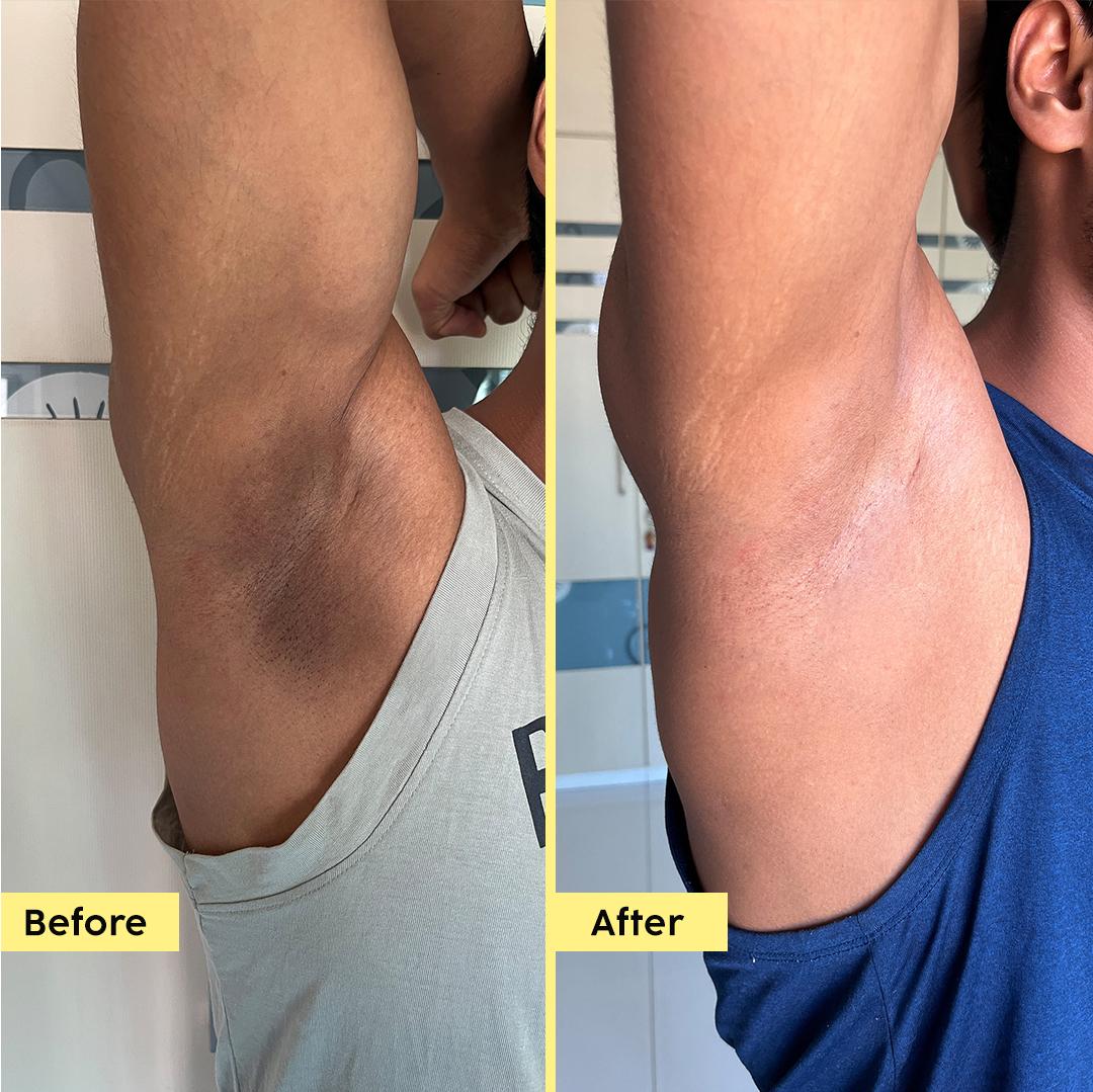 Underarm Roll-On for Odour Control & Brightening