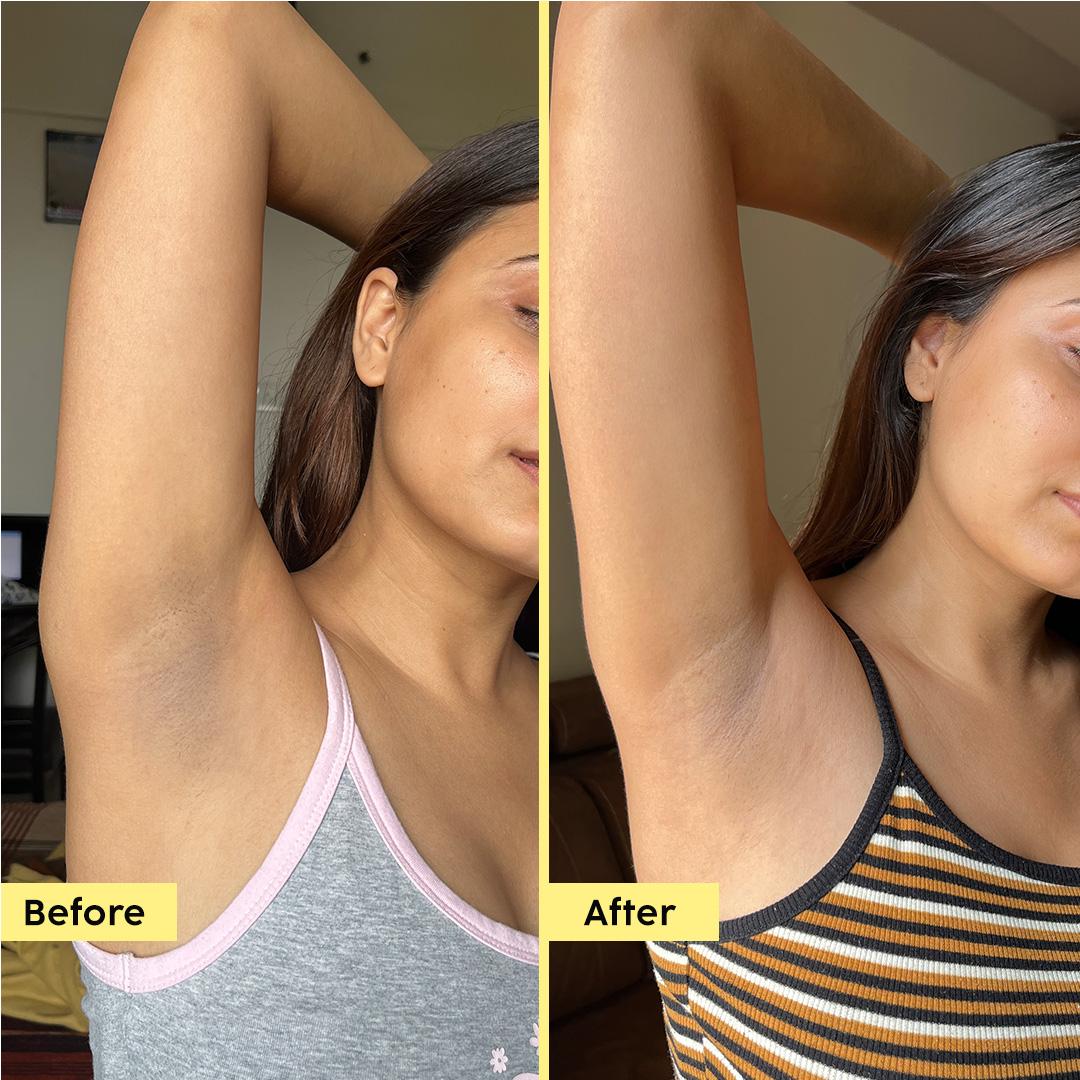 Underarm Roll-On for Odour Control & Brightening