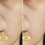 Exfoliating Fruity Toner for Smooth Skin