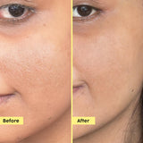 Exfoliating Fruity Toner for Smooth Skin