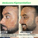 De-pigmentation Facewash, Serum & Moisturizer