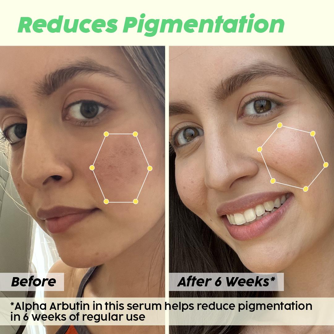 De-pigmentation Facewash, Serum & Moisturizer