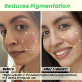 De-pigmentation Facewash, Serum & Moisturizer