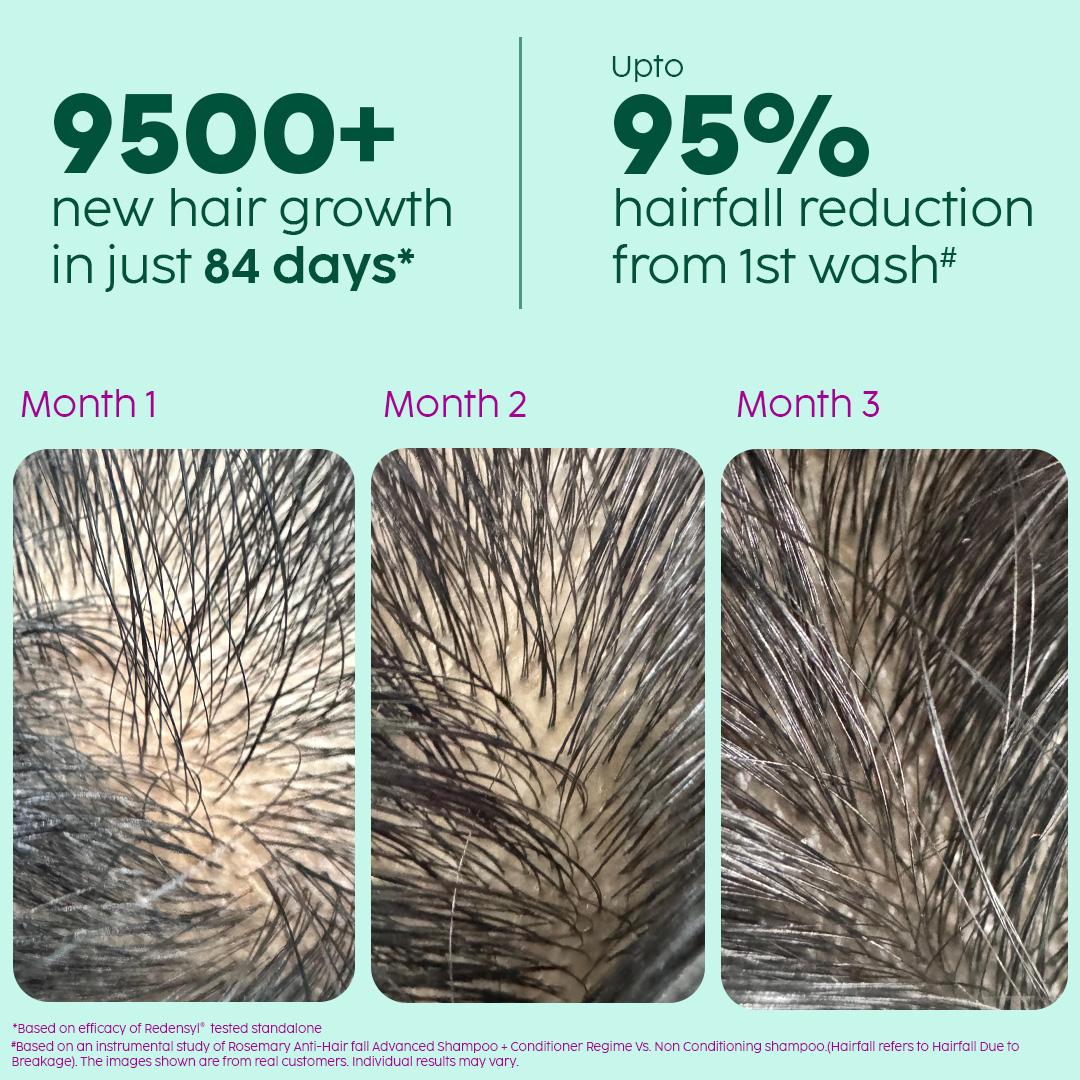 Advanced Hair Growth Serum with Key Actives