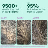 Advanced Hair Growth Serum with Key Actives