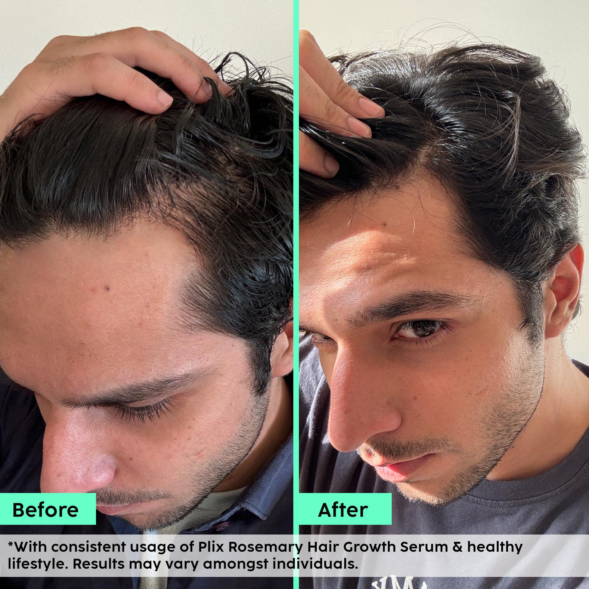 Advanced Hair Growth Serum with Key Actives