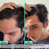 Advanced Hair Growth Serum with Key Actives