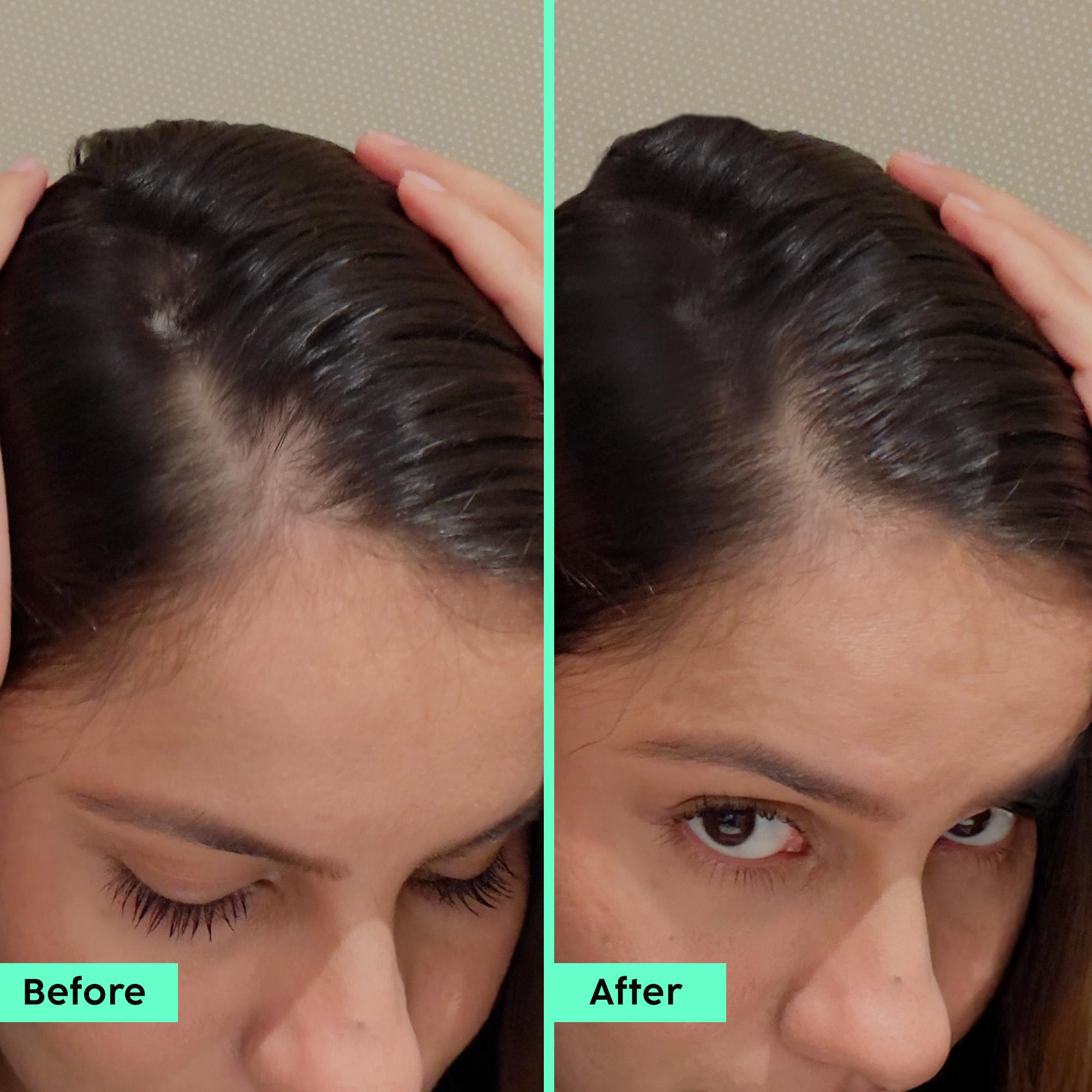Anti-Hair Fall Advanced Serum & Shampoo